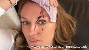 Mum 'lucky to be alive' after being hit by falling tree during Storm Boelo
