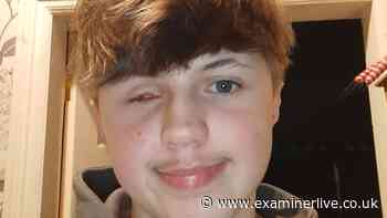 Mum's chilling Bonfire Night warning after teen inspects ‘dud’ firework with devastating results