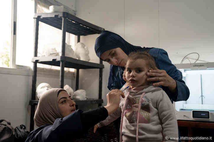 Gaza, la denuncia di Msf: “Non possiamo più produrre le maschere per i bambini ustionati a causa del blocco di Israele”