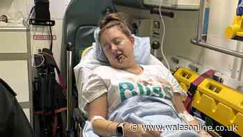 Mum of 3 ends up unconscious and in hospital while getting ready for Halloween