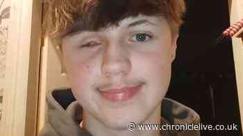 North East teen lost eye in firework accident as NHS warns of rising injuries